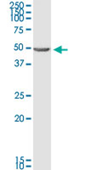 BNIP2 monoclonal antibody (M02), clone 8C6