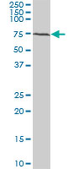 BMPR1B monoclonal antibody (M07), clone 2E2