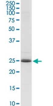 ARHGDIA MaxPab rabbit polyclonal antibody (D03)