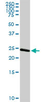 ARHGDIA MaxPab rabbit polyclonal antibody (D01)