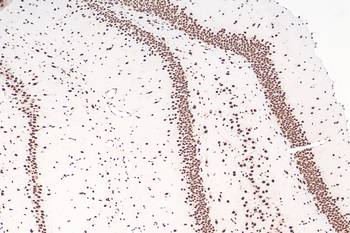 Multi-rAb Polymer HRP-Goat Anti-Rabbit Recombinant Secondary Antibody (H+L)