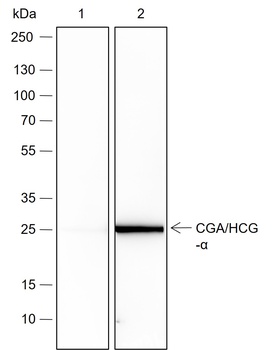 CGA/HCG-α antibody