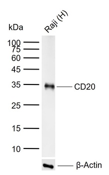 CD20 antibody