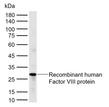 factor VIII Antibody