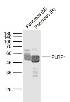 PLRP1 antibody