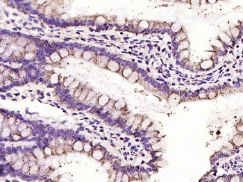 VDAC1(Mitochondrial Loading Control) antibody