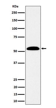 ALDH7A1 Rabbit Monoclonal Antibody