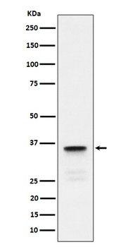 Lactate Dehydrogenase C Rabbit Monoclonal Antibody