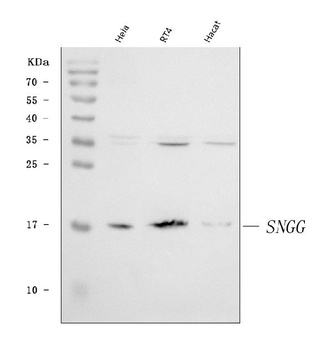 gamma Synuclein/SNCG Antibody