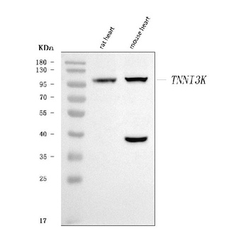 TNNI3K Antibody