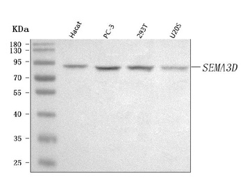 Anti-SEMA3D Antibody