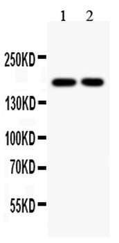 Topoisomerase II alpha/TOP2A Antibody