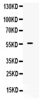 BMPR1B Antibody