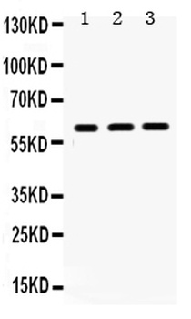 HNF1 beta/HNF1B Antibody