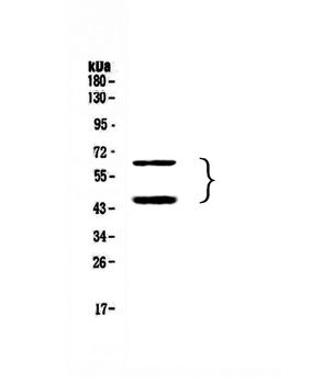TIM 3/HAVCR2 Antibody