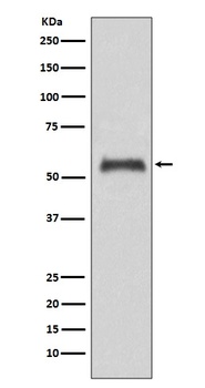 Caspase-8 CASP8 Rabbit Monoclonal Antibody
