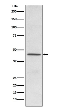 CD38 Rabbit Monoclonal Antibody
