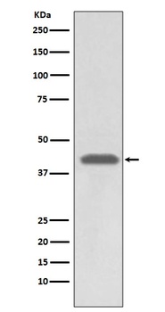 MHC class 1 HLA-A Rabbit Monoclonal Antibody