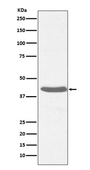 MHC class I HLA-A Rabbit Monoclonal Antibody