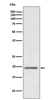 HE4 WFDC2 Rabbit Monoclonal Antibody