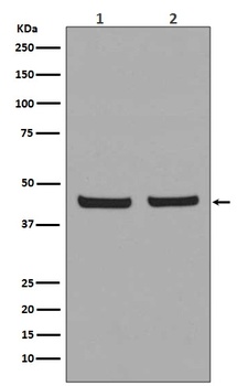 PHD1/prolyl hydroxylase Rabbit Monoclonal Antibody