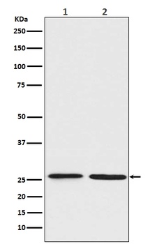 BNIP1 Rabbit Monoclonal Antibody