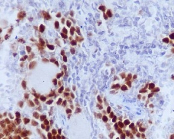 Phospho-Rb (S807) RB1 Rabbit Monoclonal Antibody