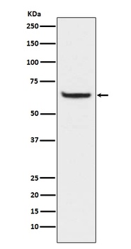 Phospho-NF-Kappa B p65 (S529) RELA Rabbit Monoclonal Antibody