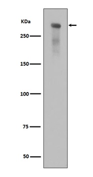 Phospho-DNA PKcs (S2056) PRKDC Rabbit Monoclonal Antibody