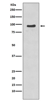 Phospho-p95/NBS1 (S343) NBN Rabbit Monoclonal Antibody