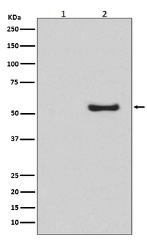 Phospho-Smad5 (S463/S465) Rabbit Monoclonal Antibody