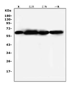 SQSTM1/p62 Antibody (monoclonal, 3H11)
