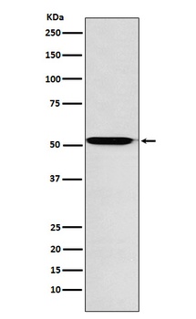 ACVR1B Rabbit Monoclonal Antibody