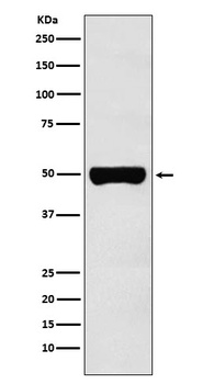 CHX10 Rabbit Monoclonal Antibody