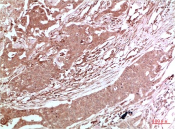 AMPK alpha2 antibody