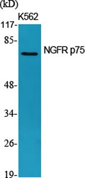 NGFR p75 antibody