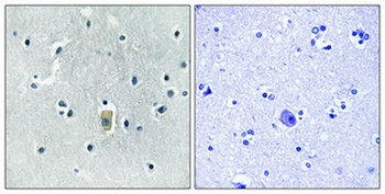 Bim (phospho-Ser59) antibody