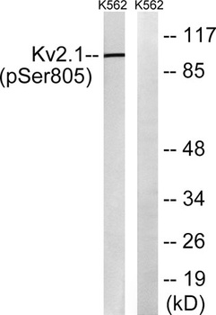KV2.1 (phospho-Ser805) antibody