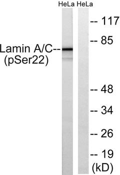 Lamin A/C (phospho-Ser22) antibody