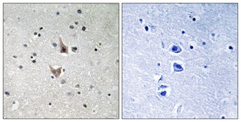 Presenilin 1 (phospho-Ser357) antibody