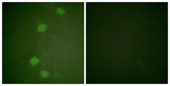 Rb (phospho-Ser249) antibody