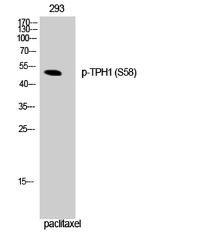 TPH1 (phospho-Ser58) antibody