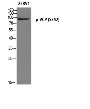 VCP (phospho-Ser352) antibody