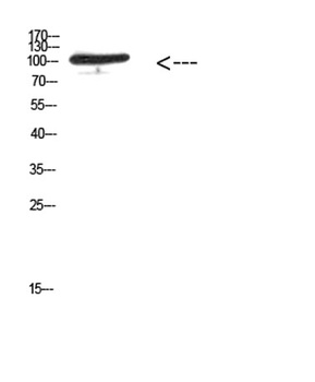 MER (Phospho-Tyr753/Tyr685) antibody