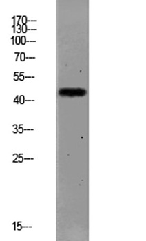 PAR1 (Cleaved-Ser42) antibody