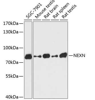 NEXN Polyclonal Antibody