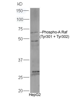 A Raf (phospho-Tyr301/302) antibody