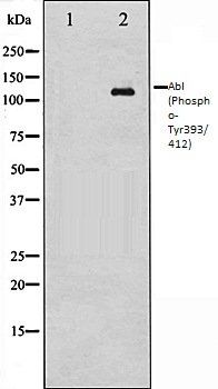 Abl (Phospho-Tyr393/412) antibody