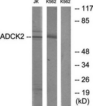 ADCK2 antibody