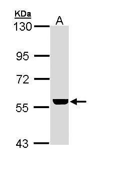 ADCK4 antibody